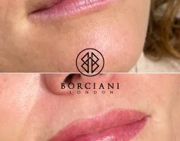 Treatment by Borciani London