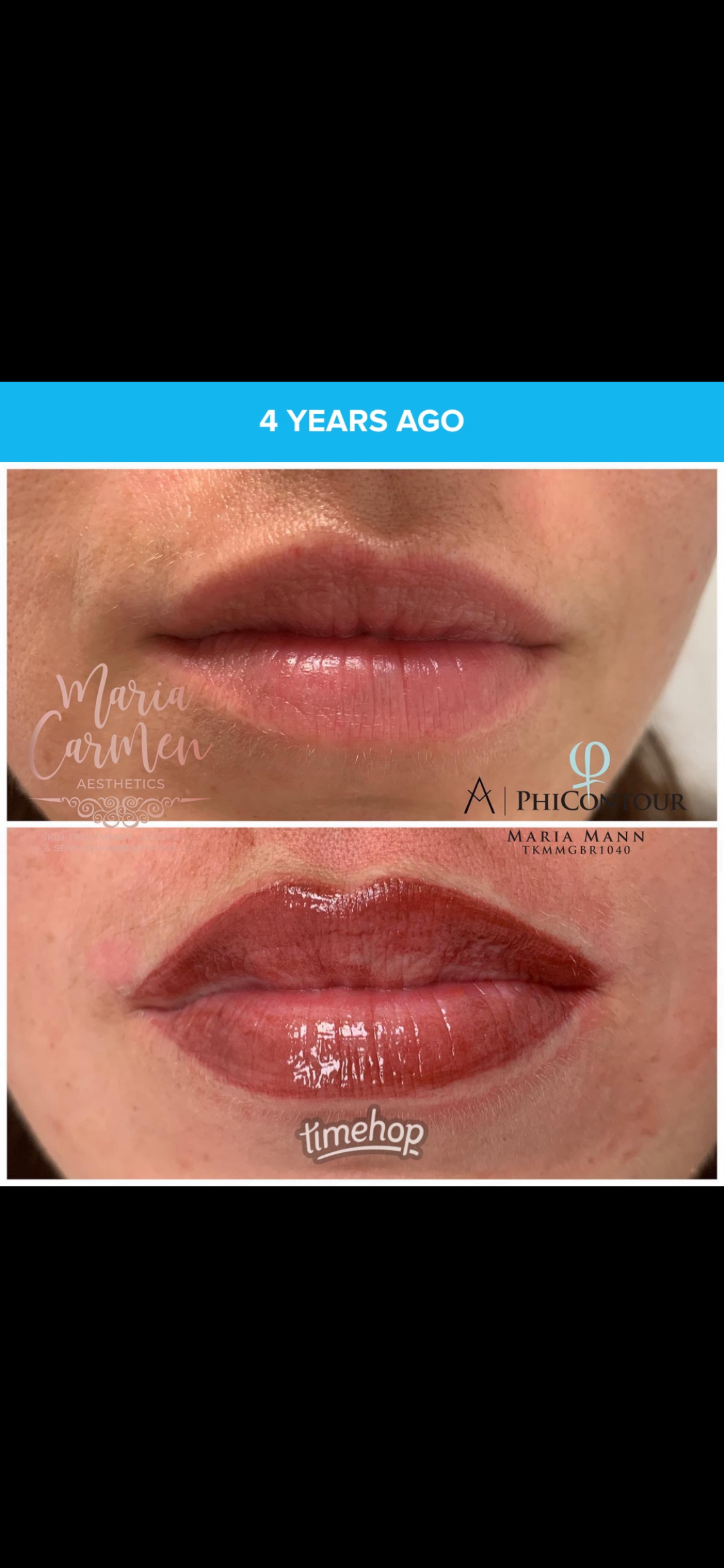 Lip Blush Tattooing (Semi-Permanent Make Up) — treatment results — at Maria Mann Aesthetics — Uckfield