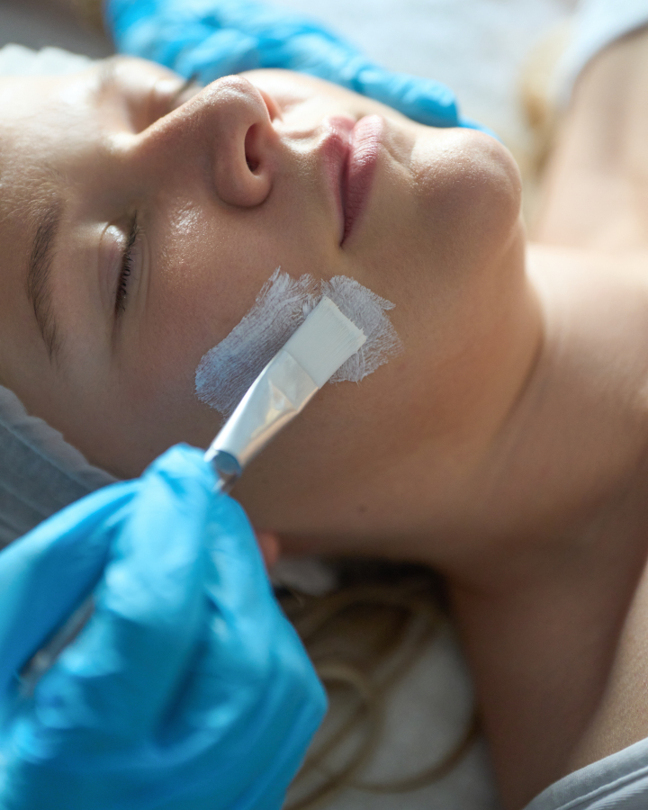Treatment by Thameside Aesthetics